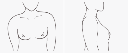 Breast Shape Bras Fit